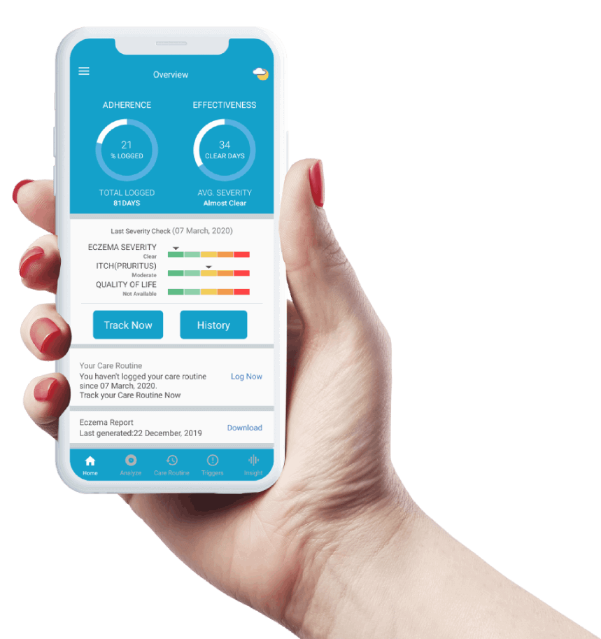AIEczemaApp